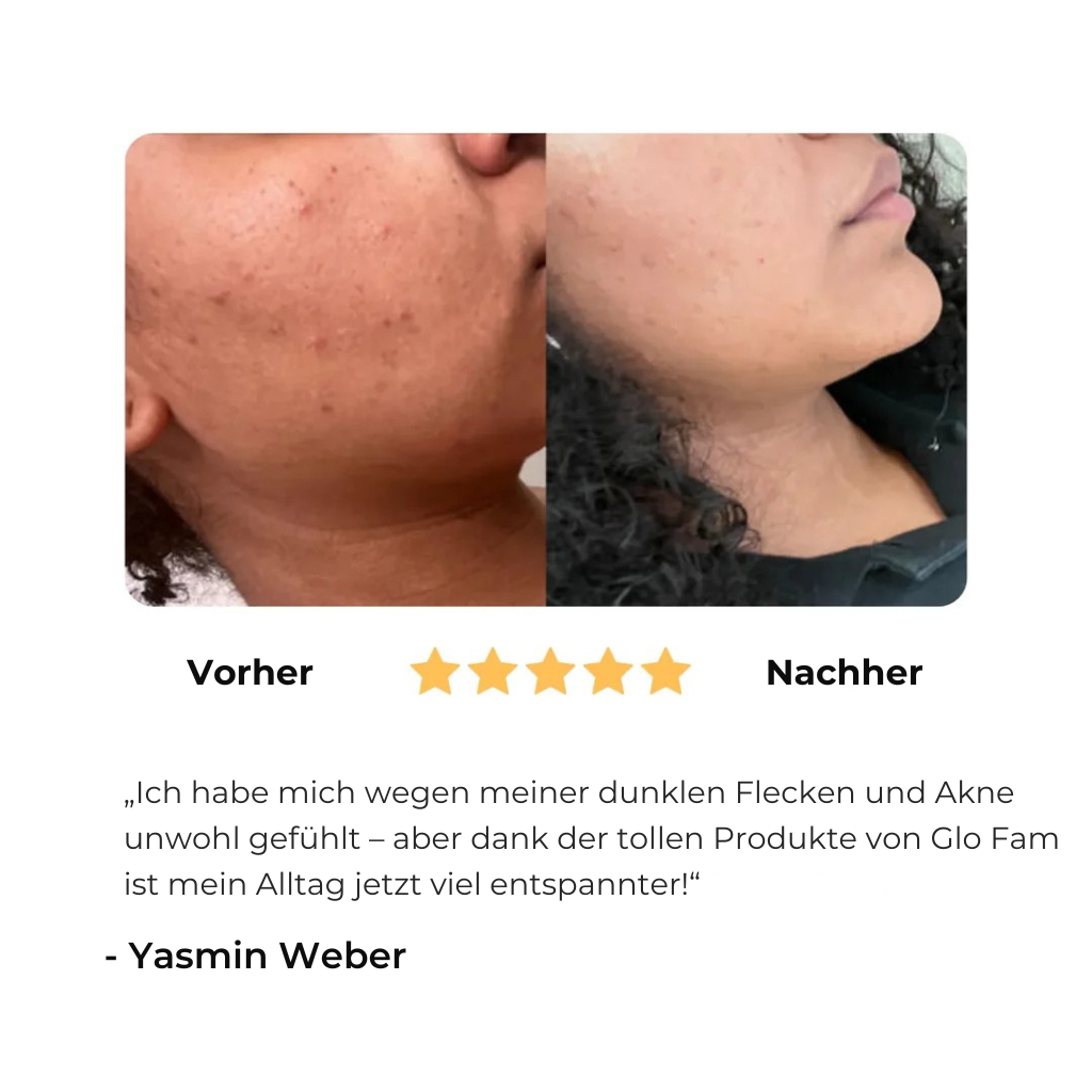 Glowmy™ Aufhellungsseife