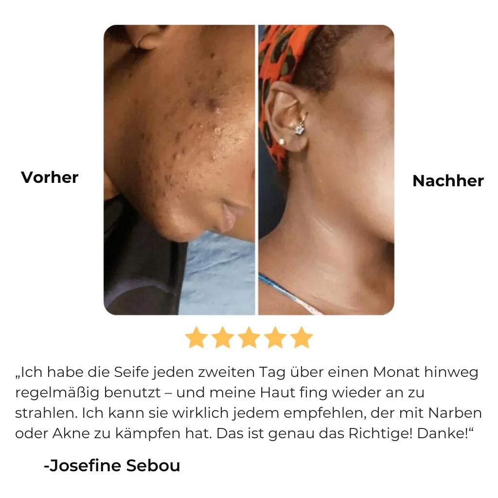 Glowmy™ Aufhellungsseife