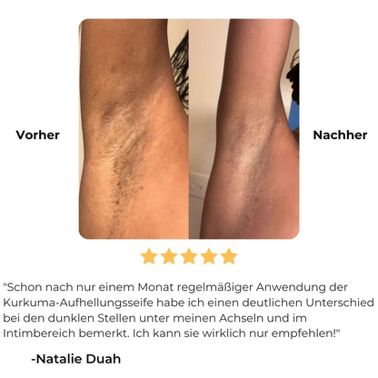Glowmy™ Aufhellungsseife